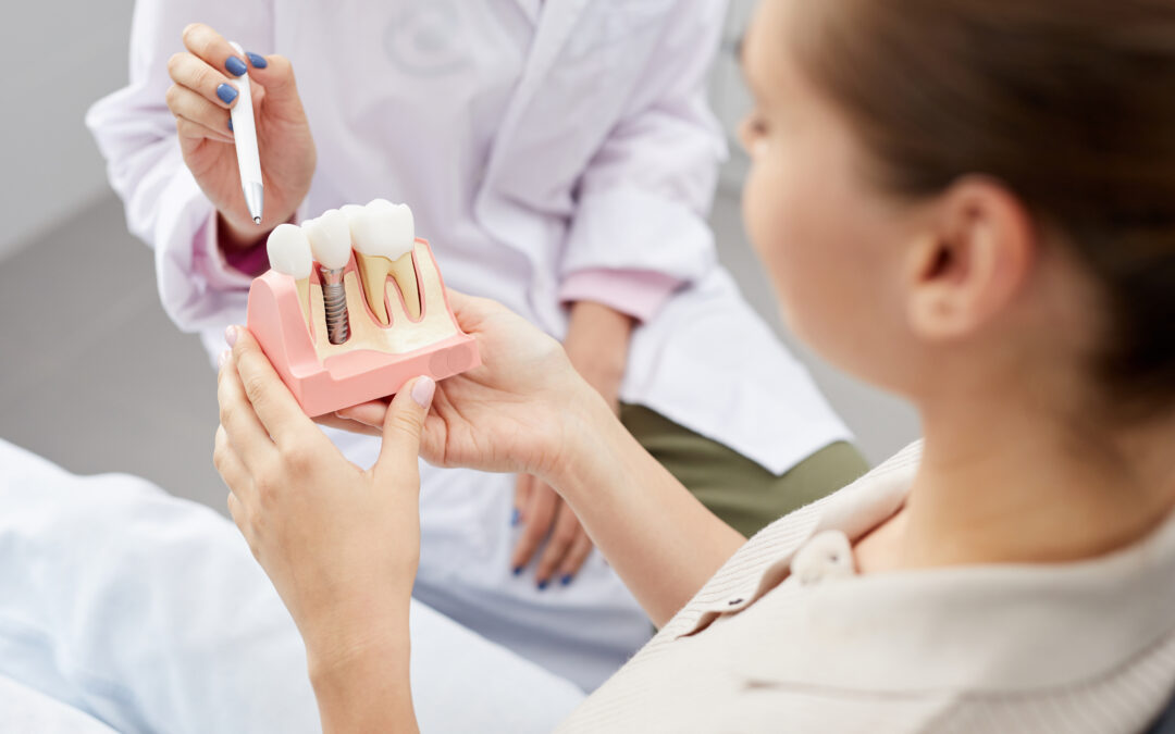 How Long Does a Tooth Implant Take? A Guide for First-Timers 