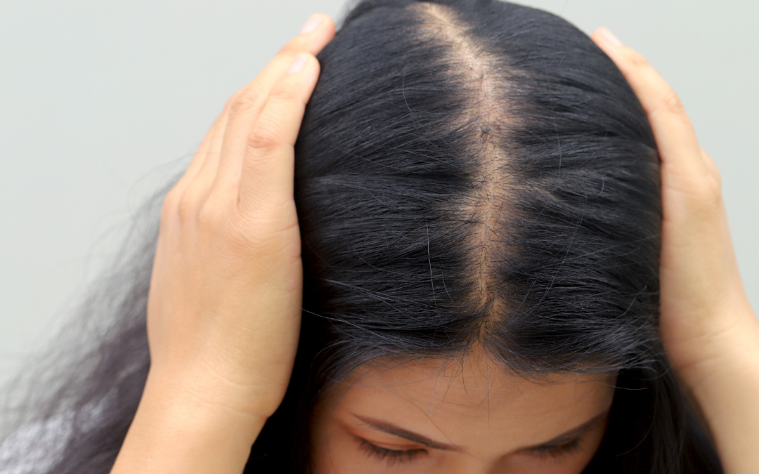 PRP for Men and Women: Can It Help with Thinning Hair?